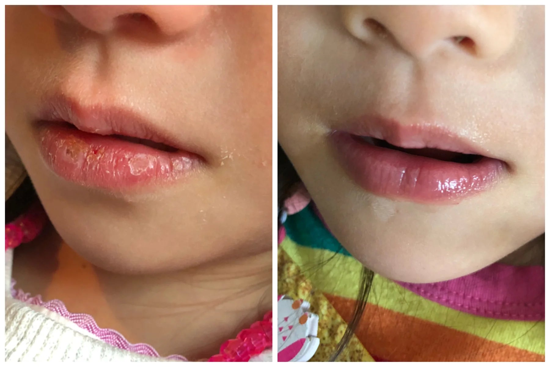 Melvory | Avo Lip Butter