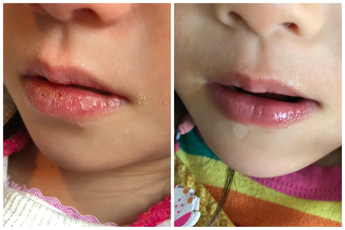 Melvory | Avo Lip Butter