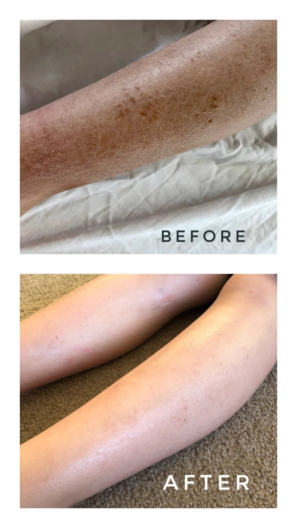 Melvory | Calendula Golden Milk Bath